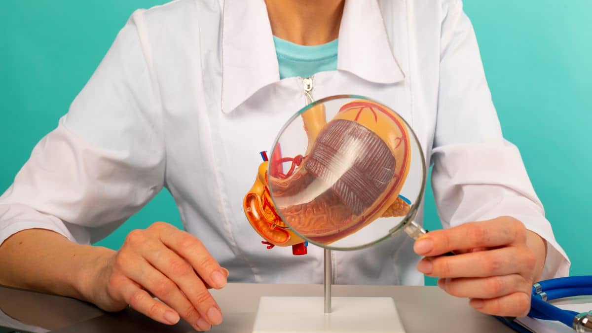 Gastrectomy, Pharmacist's, Transformation, stomach