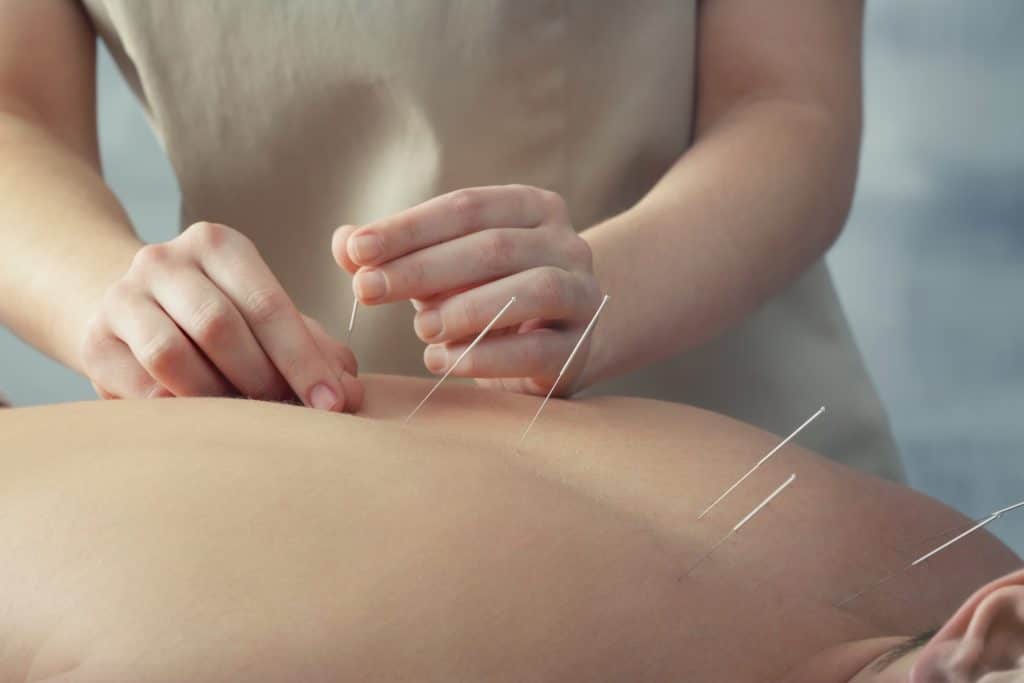 The Science Behind Acupuncture’s Effect on Muscle Recovery